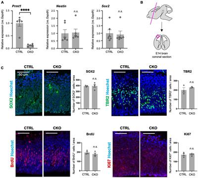 Regulation of neural stem cell proliferation and survival by protein arginine methyltransferase 1